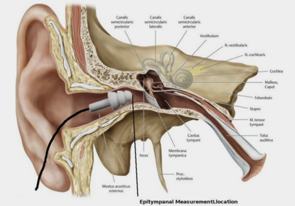 efre ear 1024x423 1 e1773387450247.png